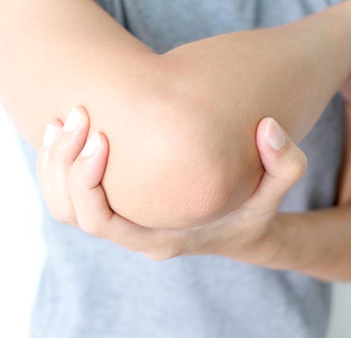 A Patient's Guide to Cubital Tunnel Syndrome - Hand and Upper Limb Clinic