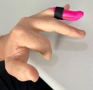 mallet finger treatment