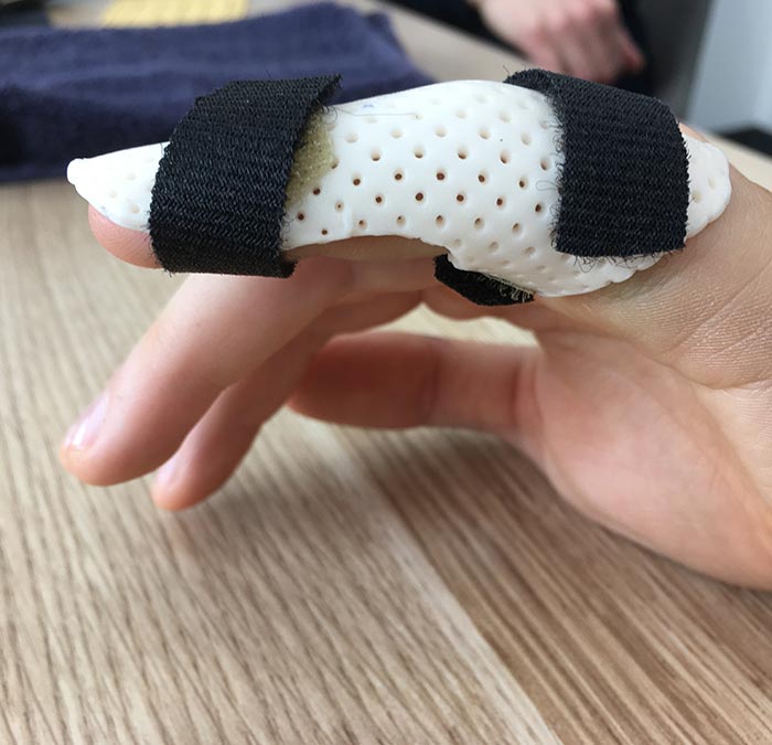 volar finger splint